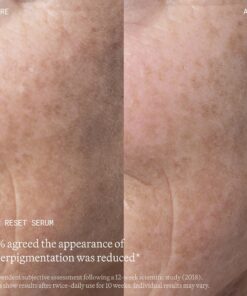 Alternative view of Gesichtsserum zur Hautaufhellung und Ausgleich des Hautbildes